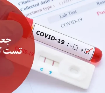 مجازات جعل تست کرونا