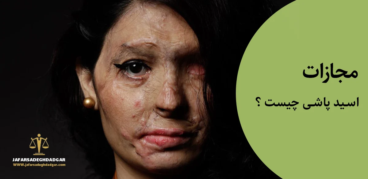 مجازات اسید پاشی